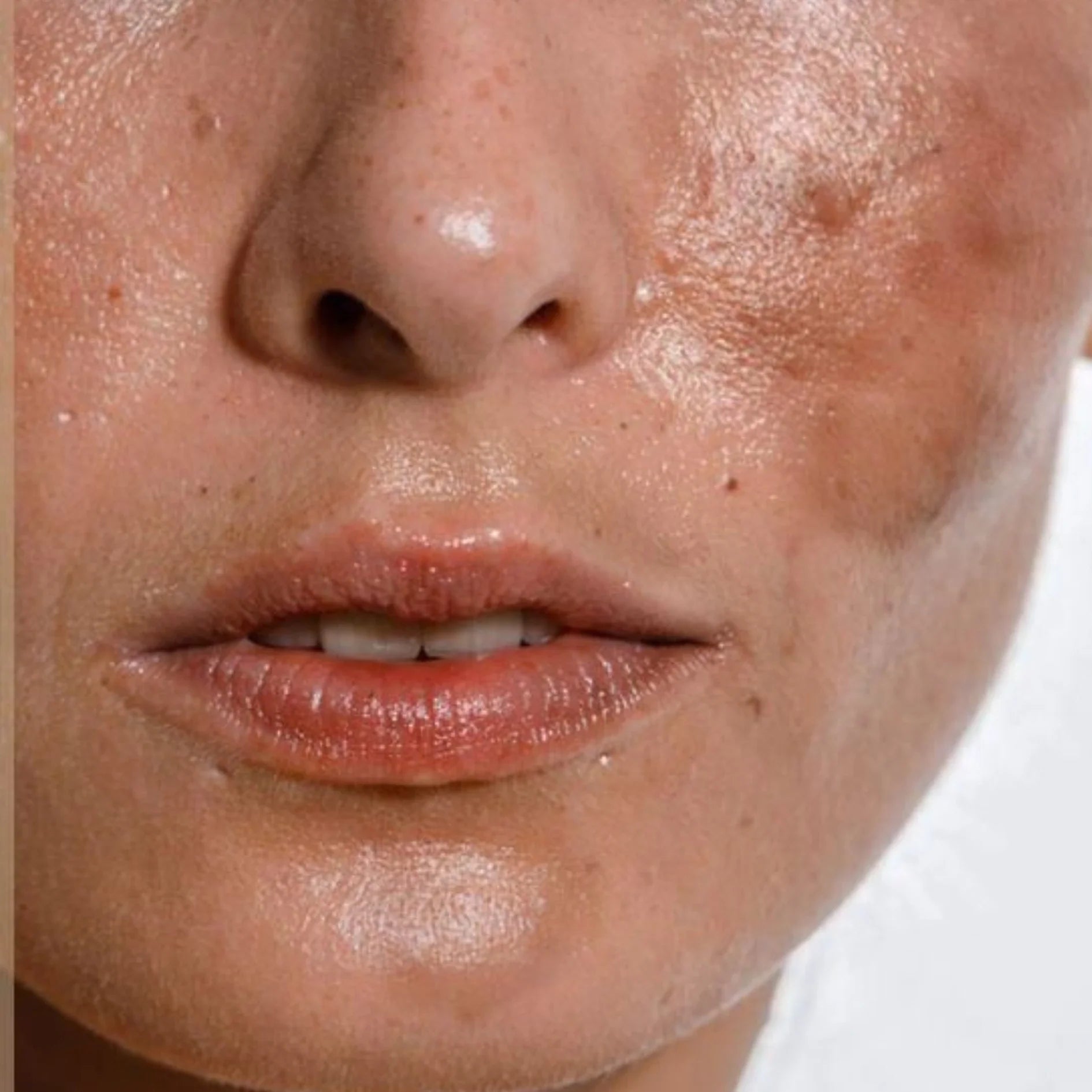 Blemish & Freckles Care