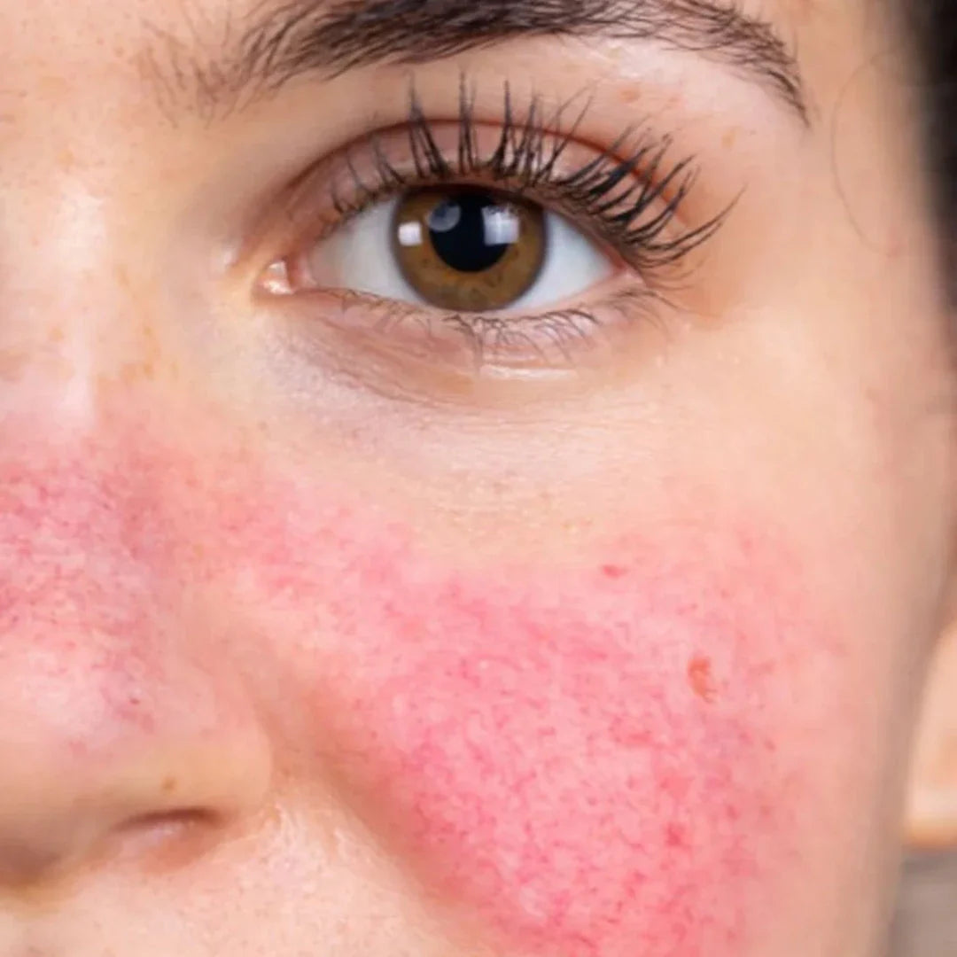Soothing Care