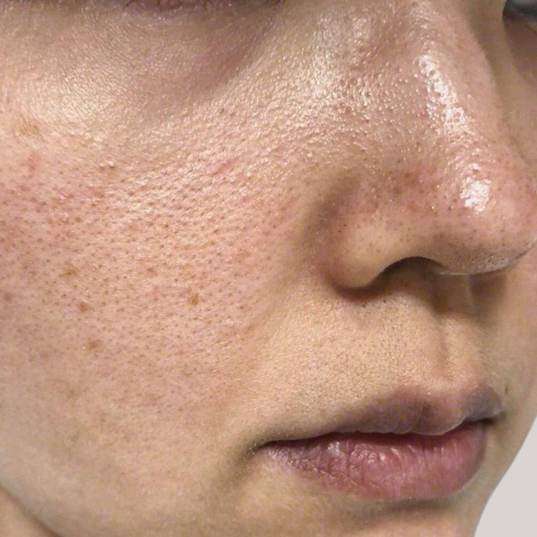 Brightening Pore Sebum Care